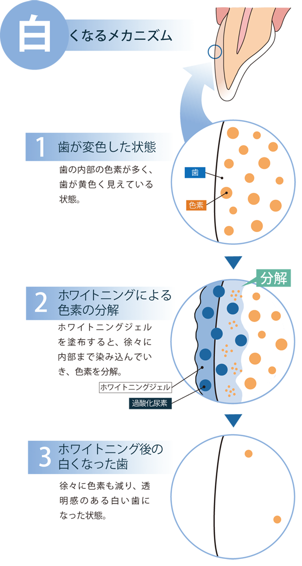 白くなるメカニズム